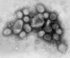 Novel H1N1 Influenza Virus